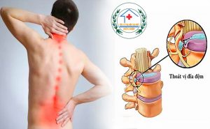 phong kham duc diep chua thoat vi dia diem tot nhat tphcm